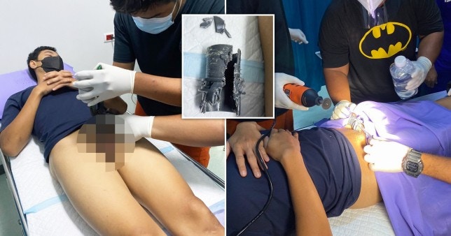 男子在做完下體增大手術後，將陰莖放入水管自慰被困。（翻攝自ViralPress）