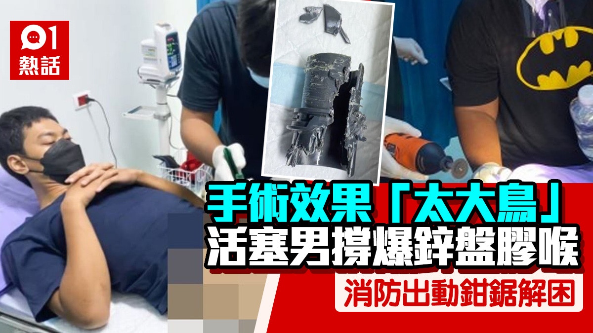 陰莖增大術效果超預期　撐爆膠喉無法自拔　男子很後悔