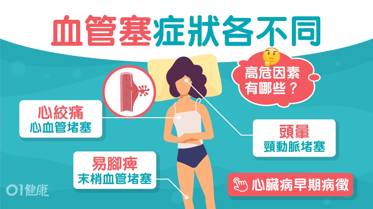 心血管健康｜血管阻塞可能無症狀！腳麻木易冰冷小心末梢血管堵塞