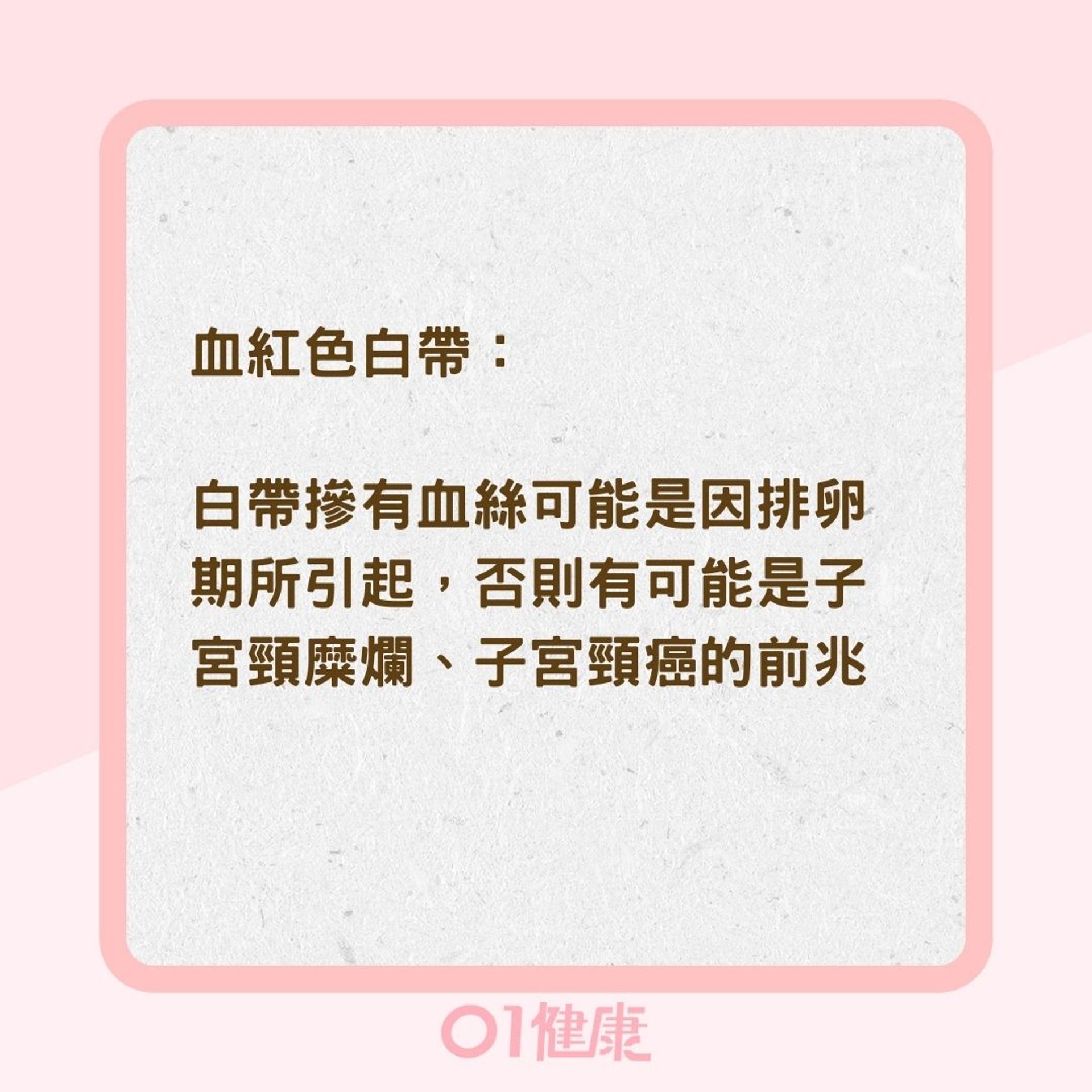 白帶顏色分辨身體狀況（01製圖）