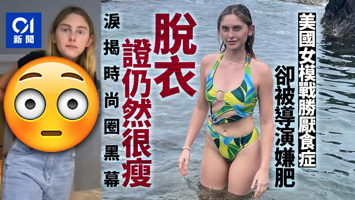 美國女模特兒花5年戰勝厭食症 竟被導演嫌肥 抖音崩潰脫衣控訴 美國女模特兒花5年戰勝厭食症 竟被導演嫌肥 抖音崩潰脫衣控訴