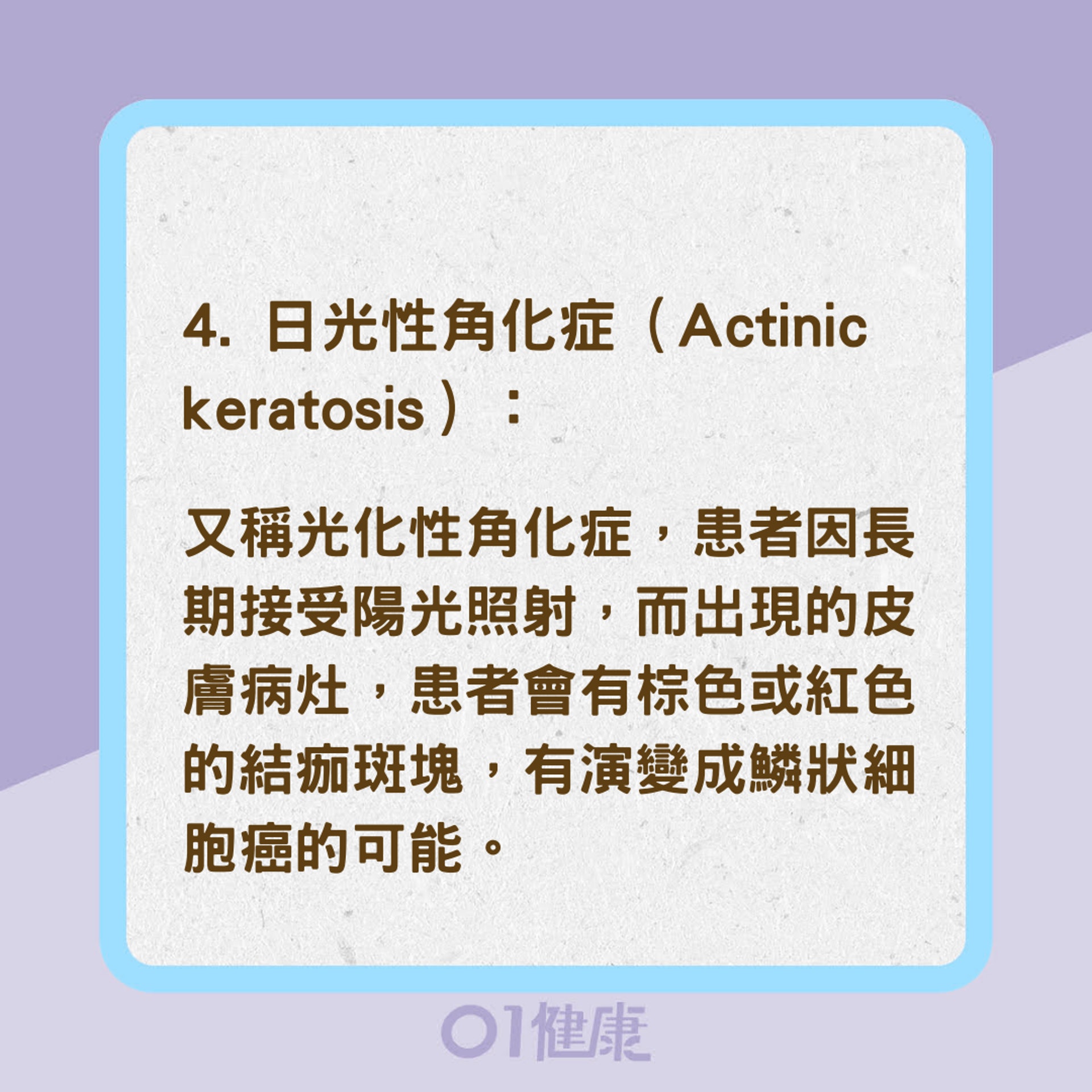 哪些因素容易導致皮膚癌?(01製圖) 哪些因素容易導致皮膚癌?(01製圖)