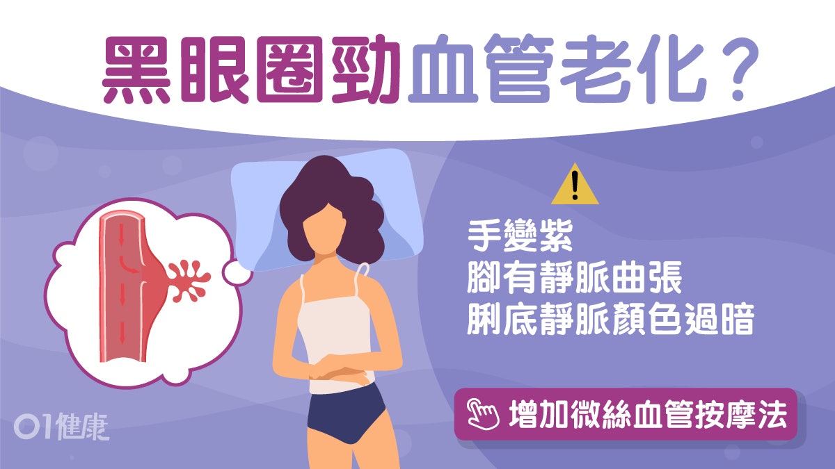 心血管疾病|黑眼圈嚴重同血管老化有關?身體4徵兆檢查血管健康 心血管疾病|黑眼圈嚴重同血管老化有關?身體4徵兆檢查血管健康