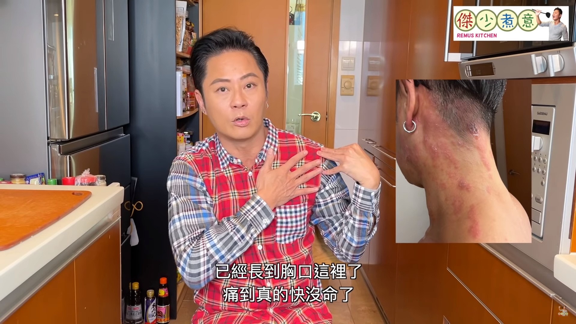 蔡一傑就指生蛇「痛到命都冇」。(影片截圖) 蔡一傑就指生蛇「痛到命都冇」。(影片截圖)