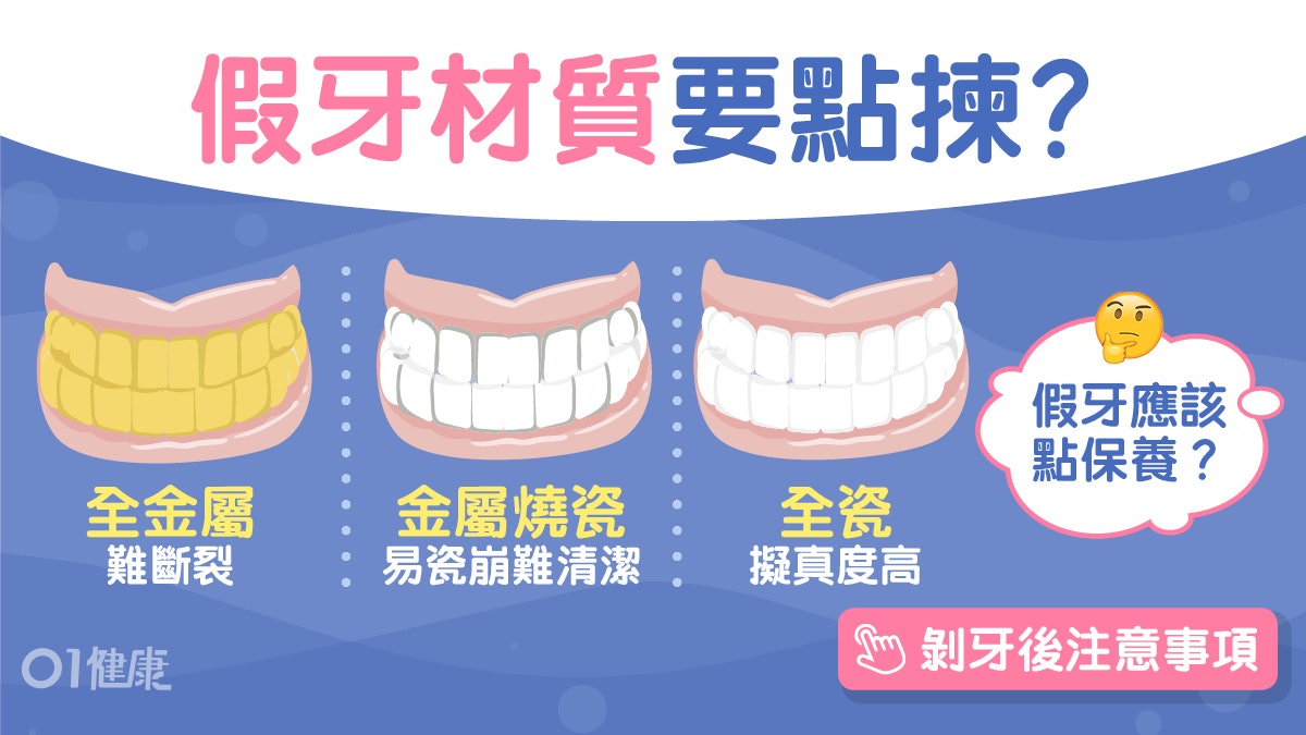 牙齒健康|假牙材質種類眾多有何差別?牙醫圖文拆解假牙保養重點 牙齒健康|假牙材質種類眾多有何差別?牙醫圖文拆解假牙保養重點