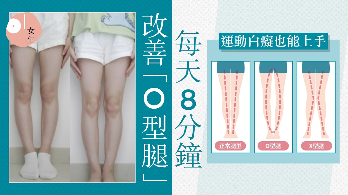 6招拯救O型腳!每天8分鐘矯正腿型預防盆骨前傾 練成修長美腿 6招拯救O型腳!每天8分鐘矯正腿型預防盆骨前傾 練成修長美腿