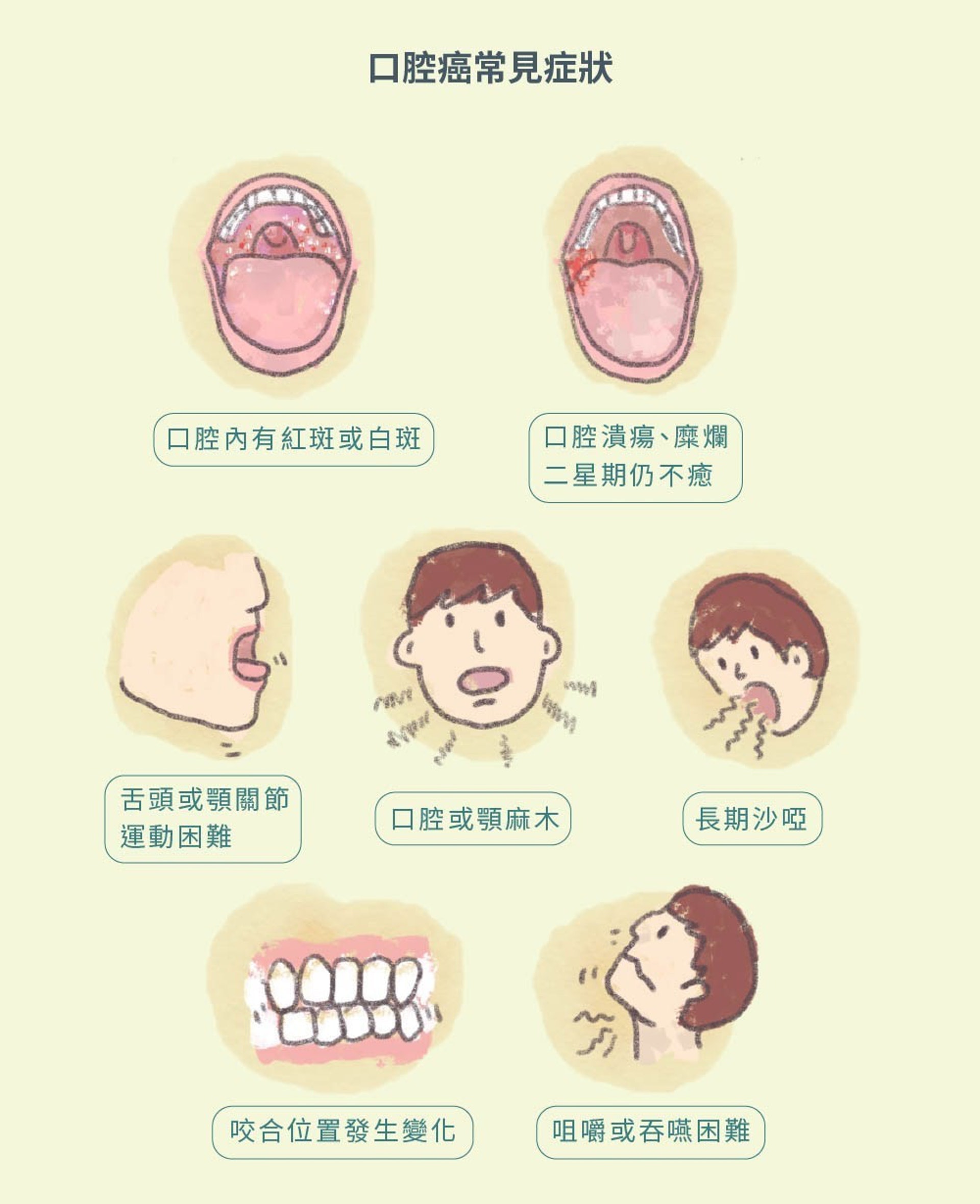 口腔癌一旦出現，惡化速度極快。初到外國的人未必可以即時接受牙科檢查或治療，有機會導致延誤治療，後果嚴重。（圖片：ihealth）
