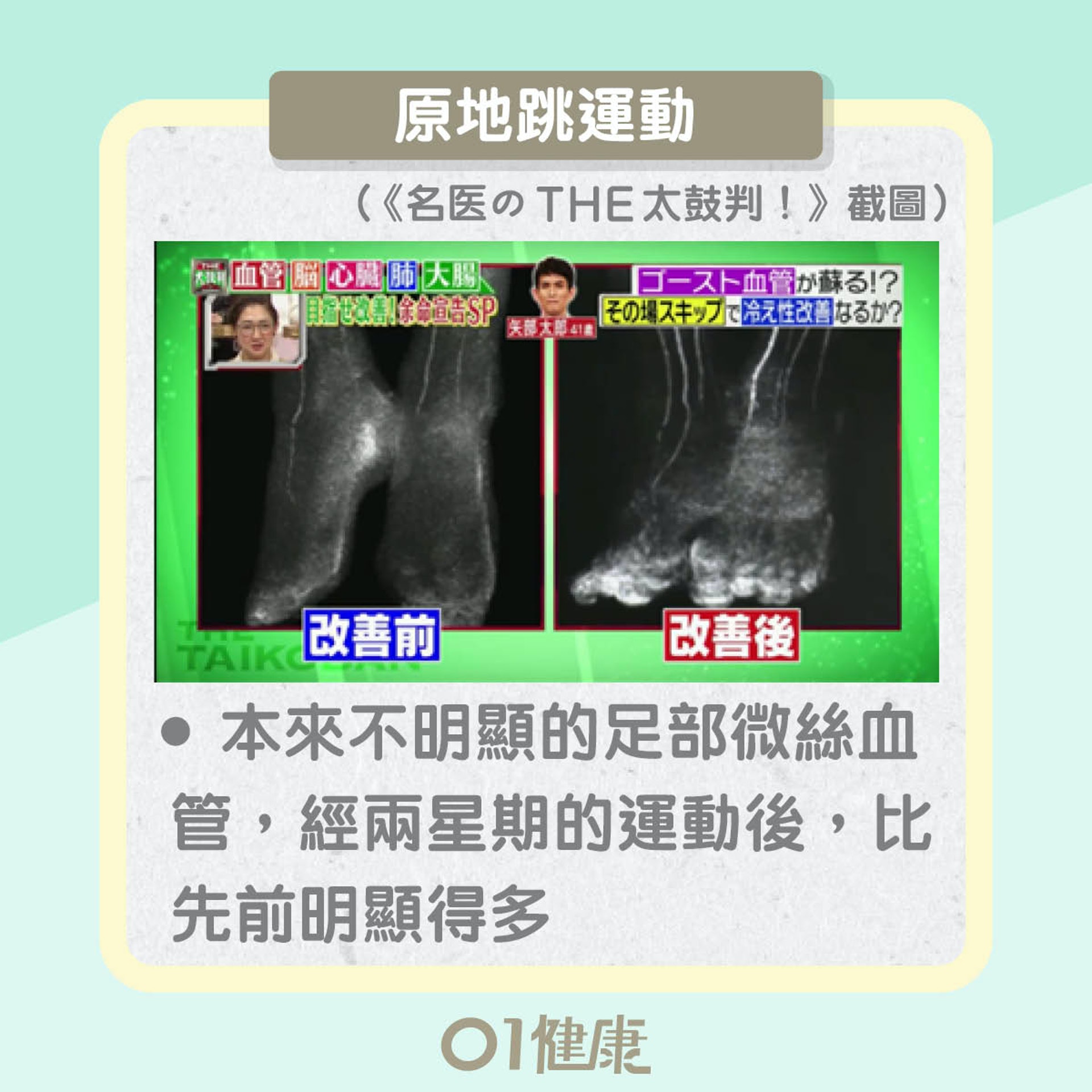 原地跳激活微絲血管(01製圖) 原地跳激活微絲血管(01製圖)