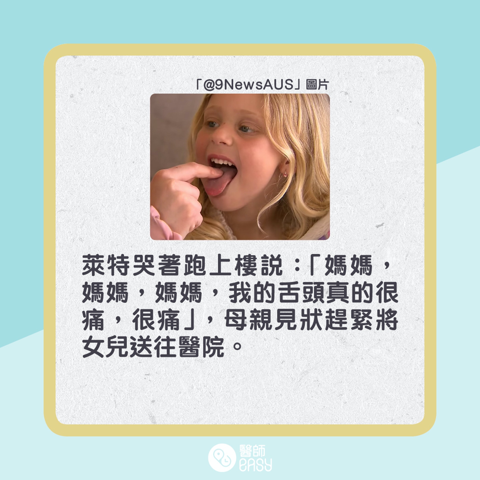 澳洲4歲女童萊德因為吃酸糖而嚴重灼傷舌頭。(01製圖) 澳洲4歲女童萊德因為吃酸糖而嚴重灼傷舌頭。(01製圖)