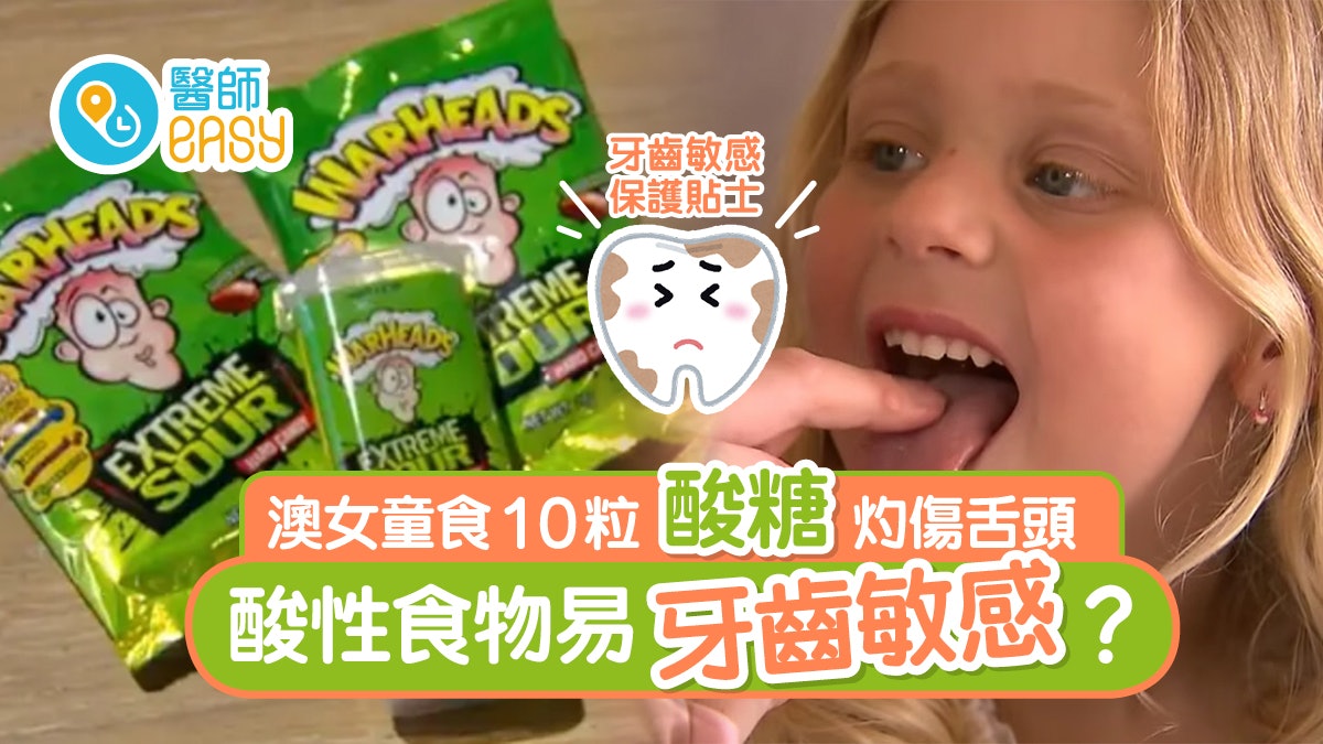 牙齒敏感|澳女童食10粒酸糖舌頭瞬灼傷 吃酸性食物即刷牙仲傷? 牙齒敏感|澳女童食10粒酸糖舌頭瞬灼傷 吃酸性食物即刷牙仲傷?