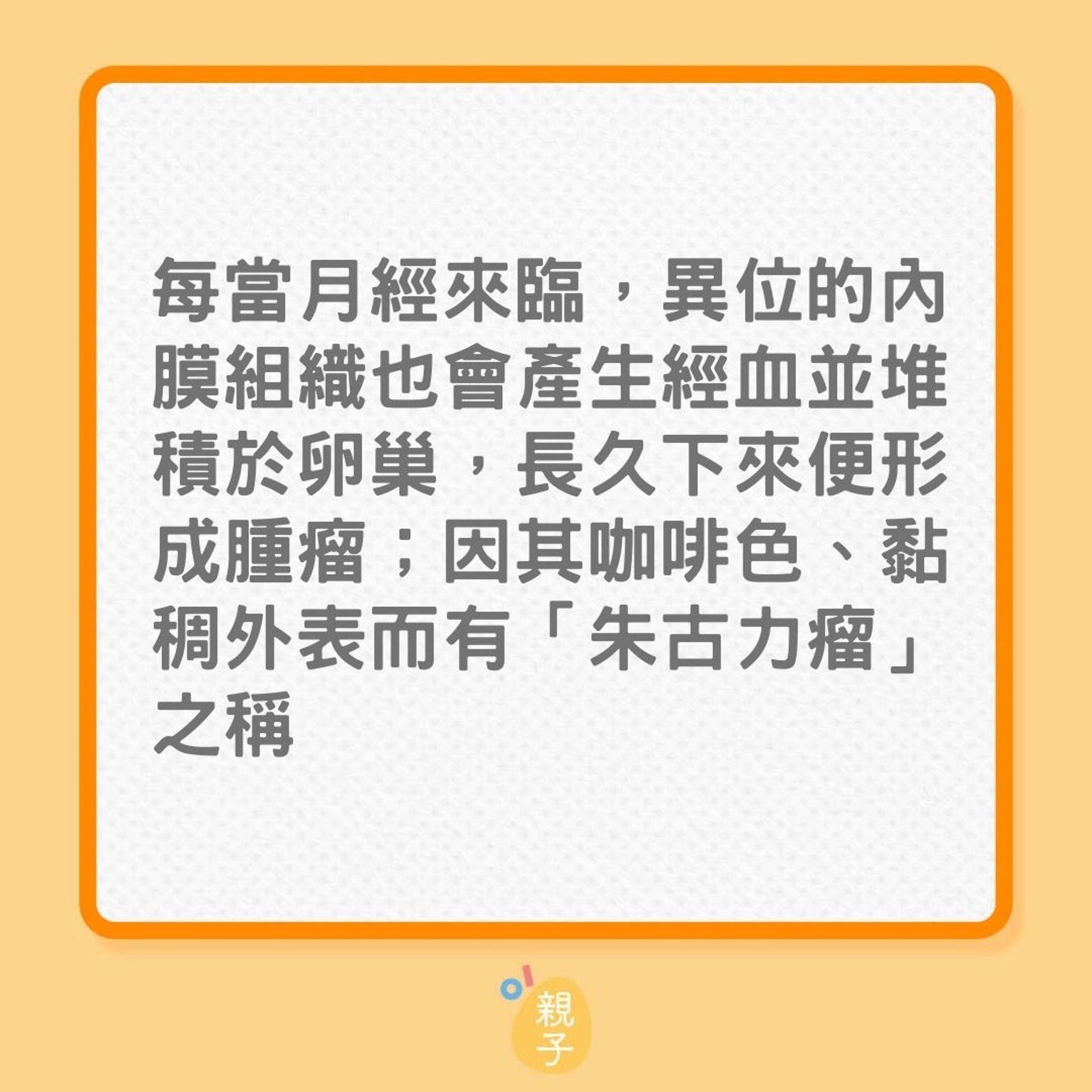 不孕|了解更多朱古力瘤(01製圖) 不孕|了解更多朱古力瘤(01製圖)
