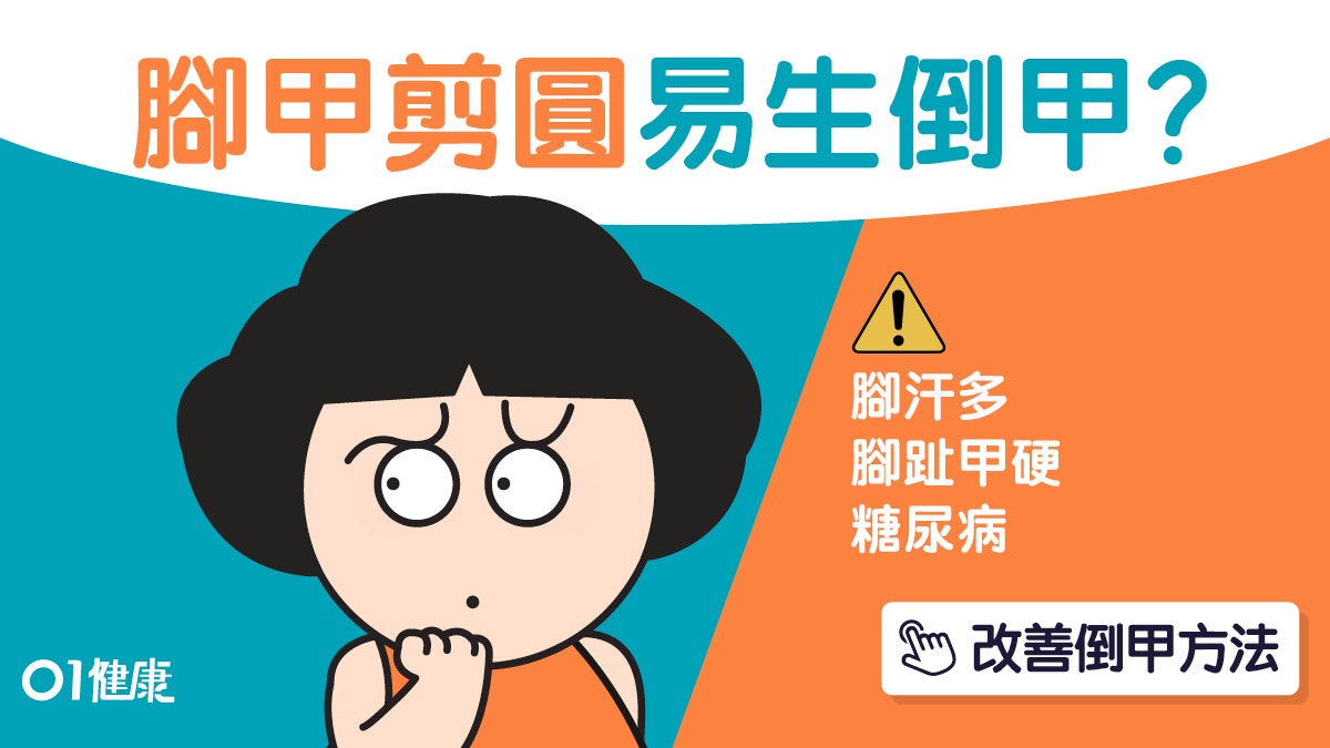 腳趾倒甲|著鞋好痛可能有嵌甲!教你正確剪腳甲方法改善嵌甲症狀 腳趾倒甲|著鞋好痛可能有嵌甲!教你正確剪腳甲方法改善嵌甲症狀