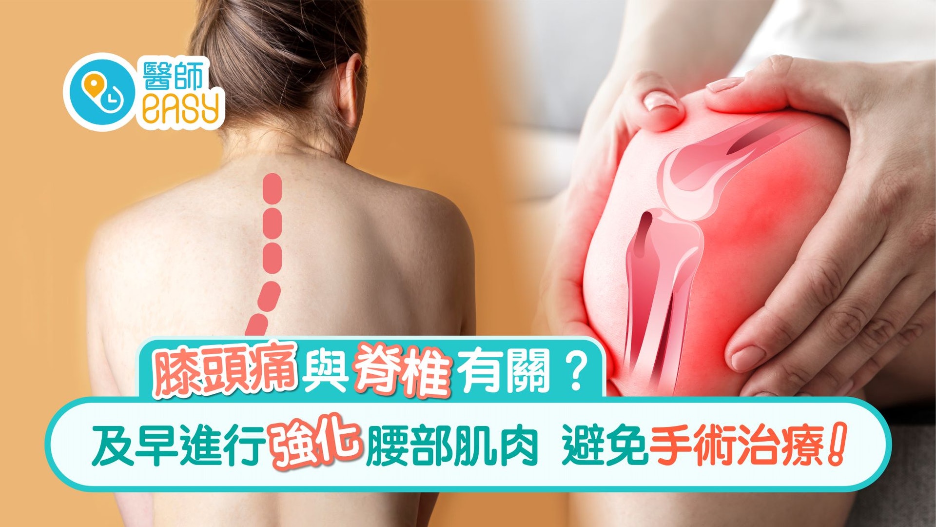 脊椎側彎|全港5%人患上 頭痛便秘可能源於此?治療方法有新突破 脊椎側彎|全港5%人患上 頭痛便秘可能源於此?治療方法有新突破