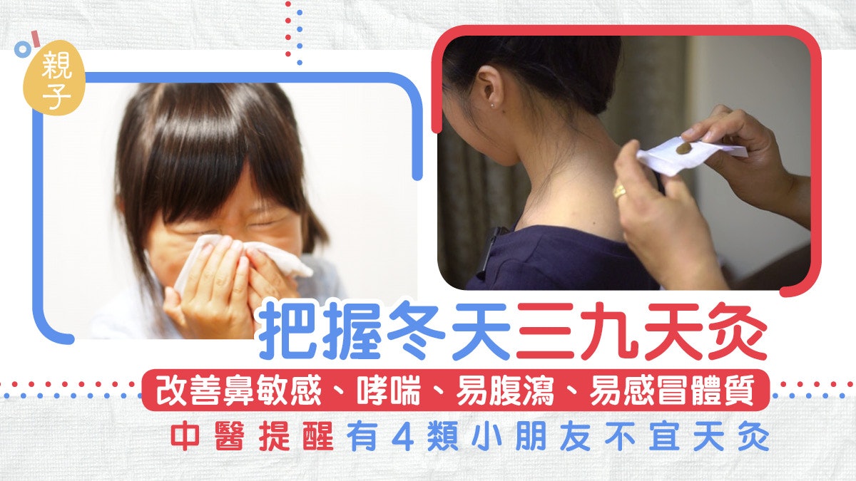 天炙|把握冬天三九灸有效改善兒童鼻敏感 中醫:4類人士不宜 天炙|把握冬天三九灸有效改善兒童鼻敏感 中醫:4類人士不宜