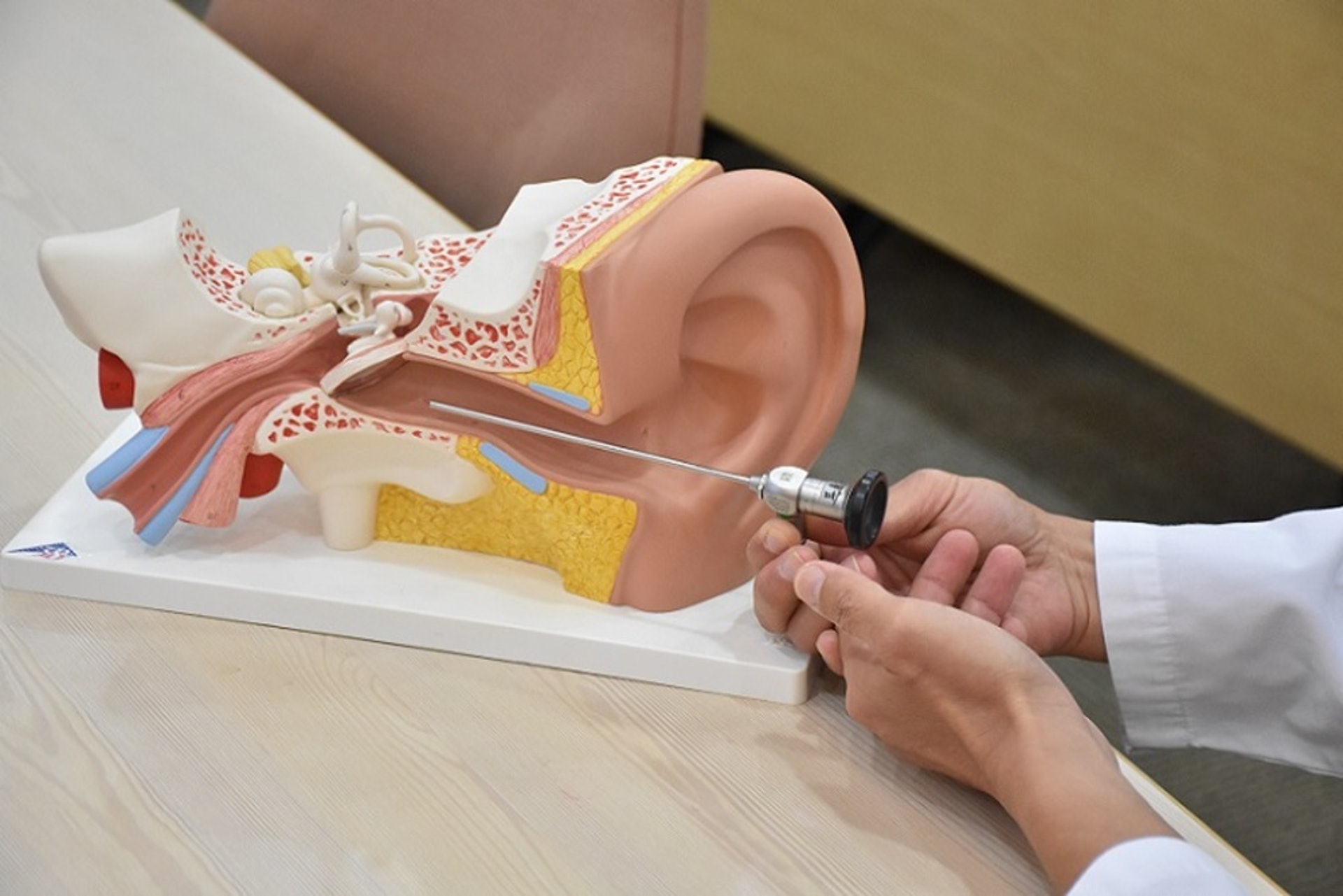 病情較嚴重的話，便可能需要進行「引流手術」，將中耳腔的積液引流出來。方法是在耳膜開個小洞或置入通氣管，將積液引流出來。（圖片：fengmin）