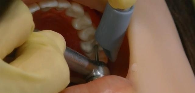 沖繩港爸嘆牙科保健是童年陰影女兒看日本牙醫節目俾呢樣嘢嚇親