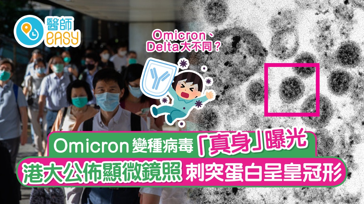 Omicron變種病毒「真身」曝光 港大公布顯微鏡照刺突蛋白呈皇冠形 Omicron變種病毒「真身」曝光 港大公布顯微鏡照刺突蛋白呈皇冠形