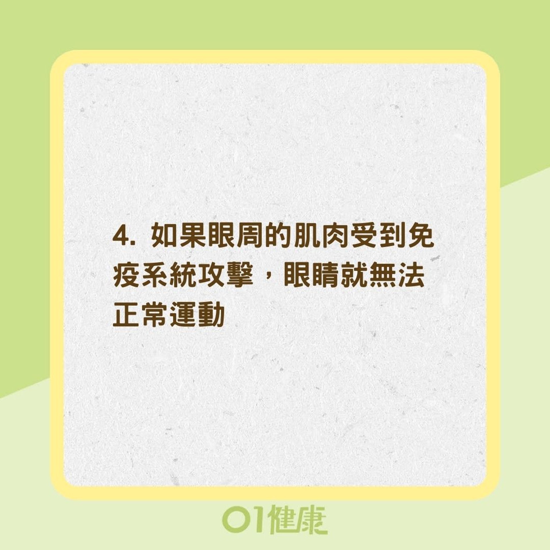 甲狀腺眼病變的症狀(01製圖) 甲狀腺眼病變的症狀(01製圖)