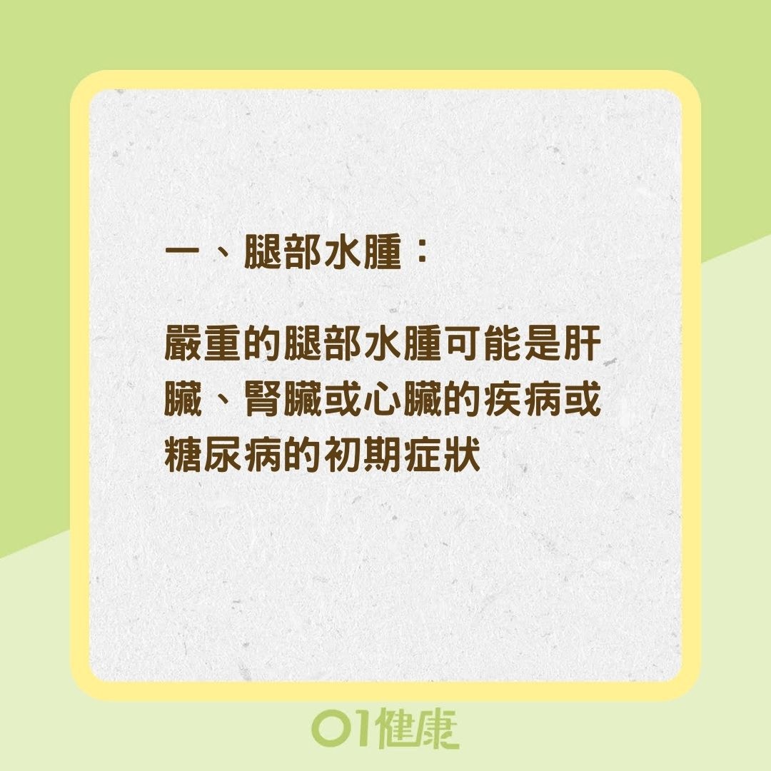 注意腿部的五大警訊（01製圖）