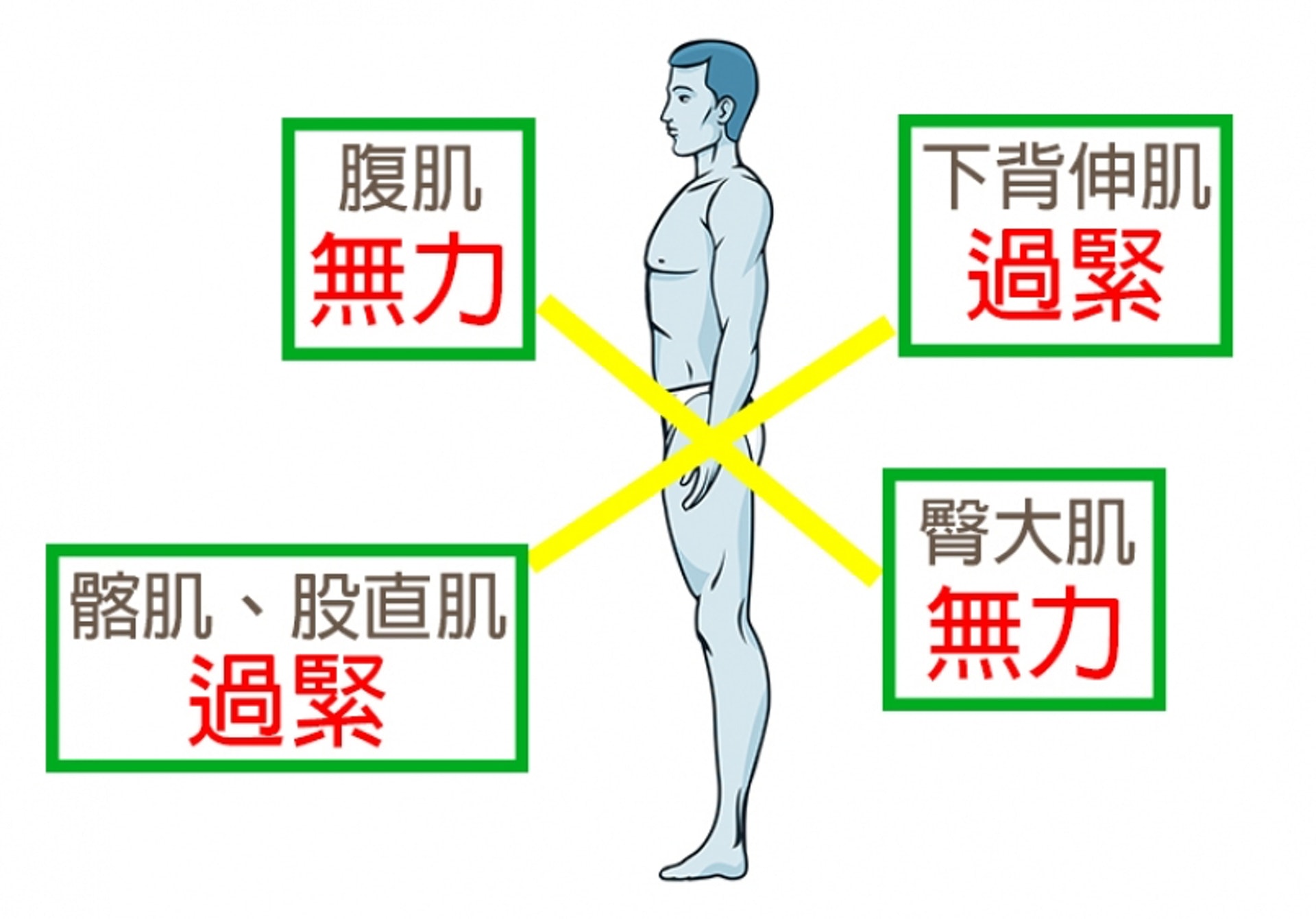 下交叉綜合症即是腰部、腹部、臀部和腿部的肌肉不平衡。（圖片：running.biji.co）