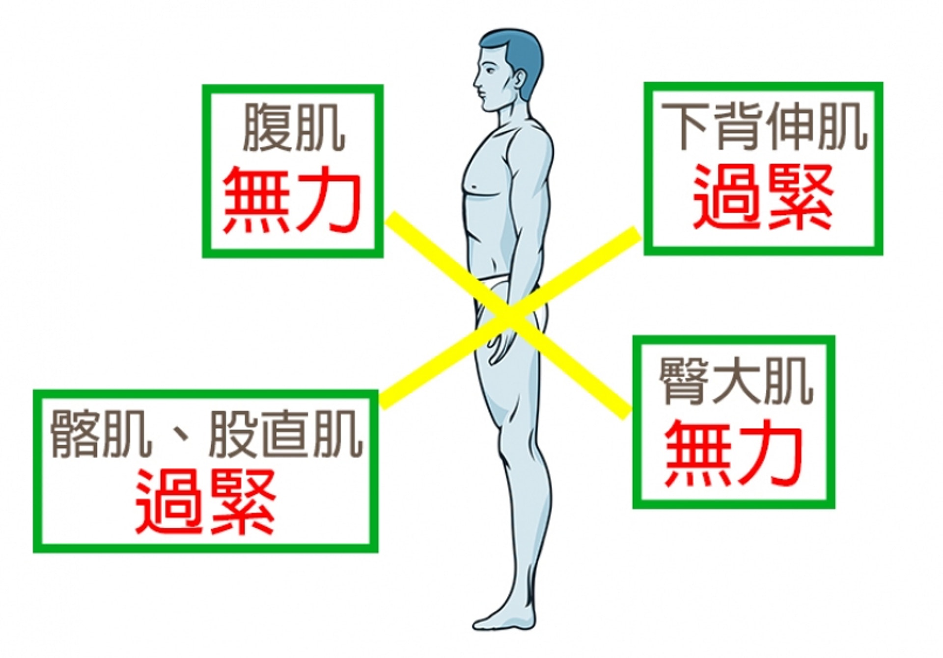 下交叉綜合症即是腰部、腹部、臀部和腿部的肌肉不平衡。(圖片:running.biji.co) 下交叉綜合症即是腰部、腹部、臀部和腿部的肌肉不平衡。(圖片:running.biji.co)