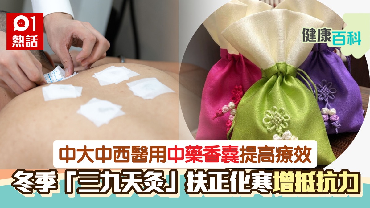 天灸治療與香囊並用療效更佳　中大中西醫推三九天灸計劃｜附詳情