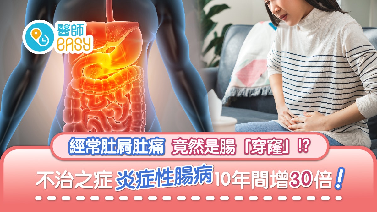 腸炎|肚痾肚痛不一定是腸胃炎?症狀會終身伴隨 嚴重需切除腸道 腸炎|肚痾肚痛不一定是腸胃炎?症狀會終身伴隨 嚴重需切除腸道