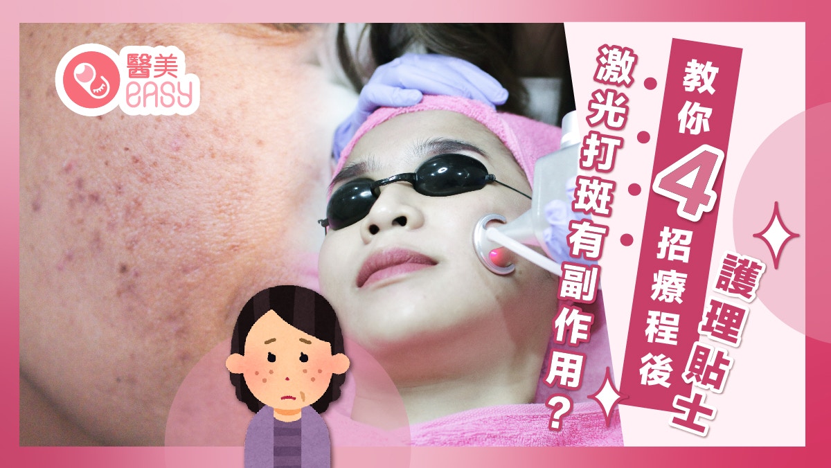打斑