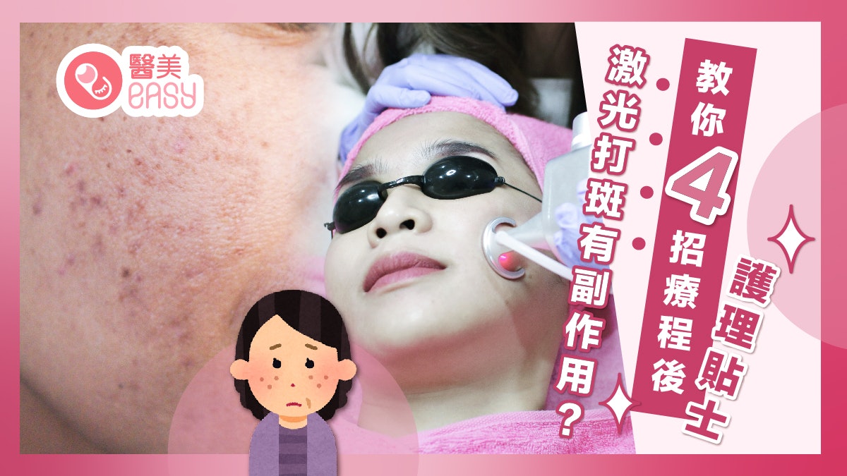 打斑