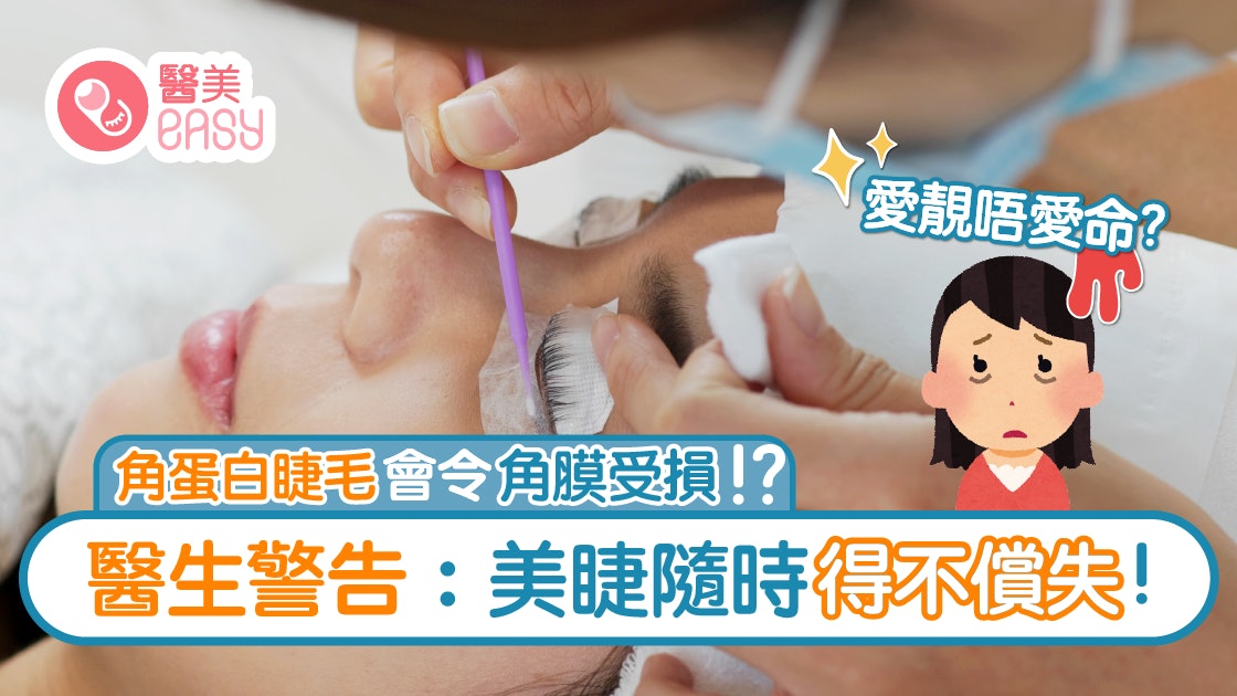 角蛋白睫毛│胡亂美睫隨時影響視力 眼科醫生和你剖析美睫風險 角蛋白睫毛│胡亂美睫隨時影響視力 眼科醫生和你剖析美睫風險