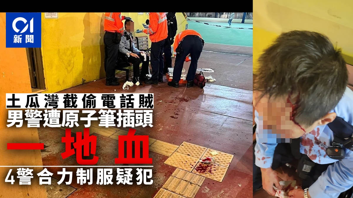 土瓜灣男警截盜竊賊遇反抗遭原子筆插頭血流一地