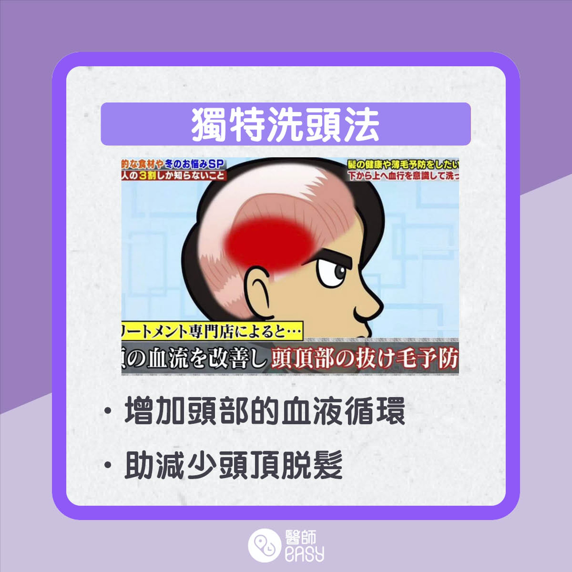 防脫髮洗髮方法。(01製圖) 防脫髮洗髮方法。(01製圖)