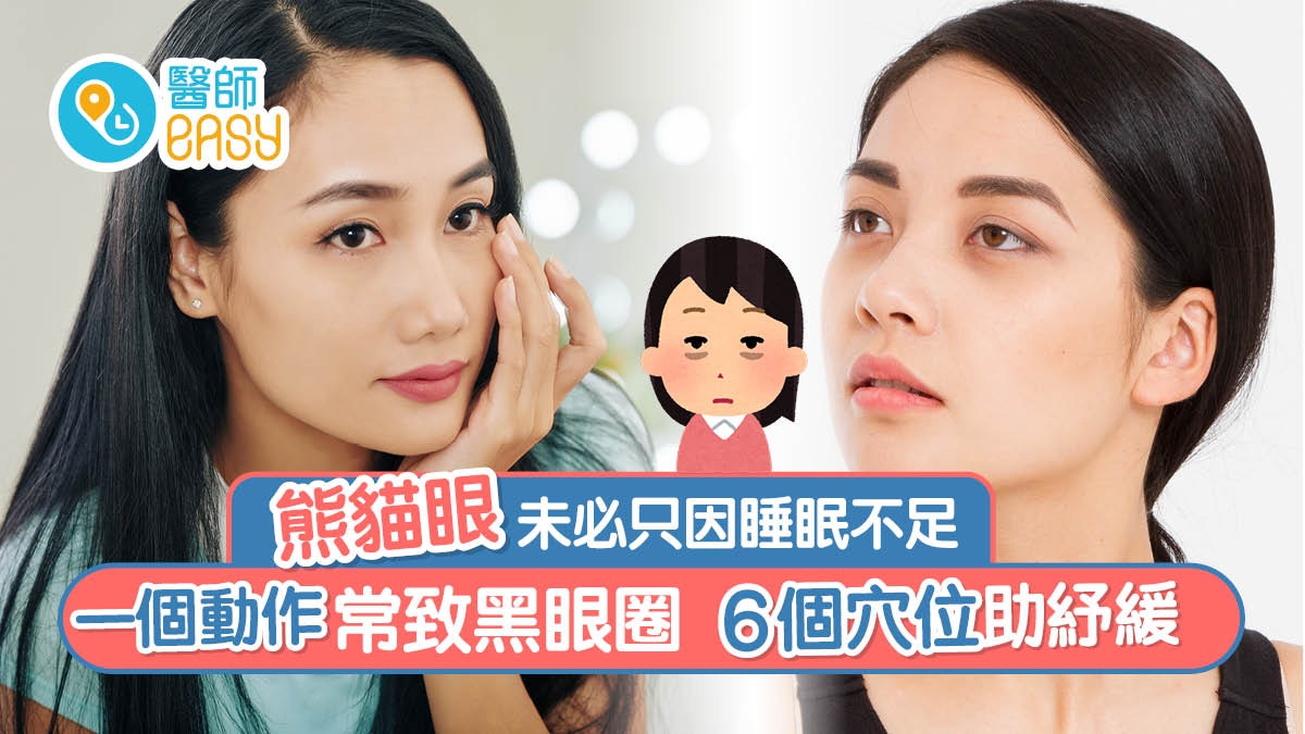 黑眼圈｜熊貓眼未必因睡眠不足 一個動作常致黑眼圈6個穴位助紓緩