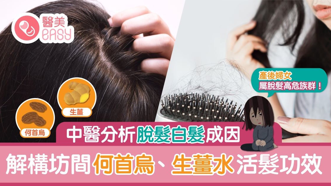 防治脫髮│中醫淺談脫髮白髮 解構坊間生薑水及梳頭效用 防治脫髮│中醫淺談脫髮白髮 解構坊間生薑水及梳頭效用