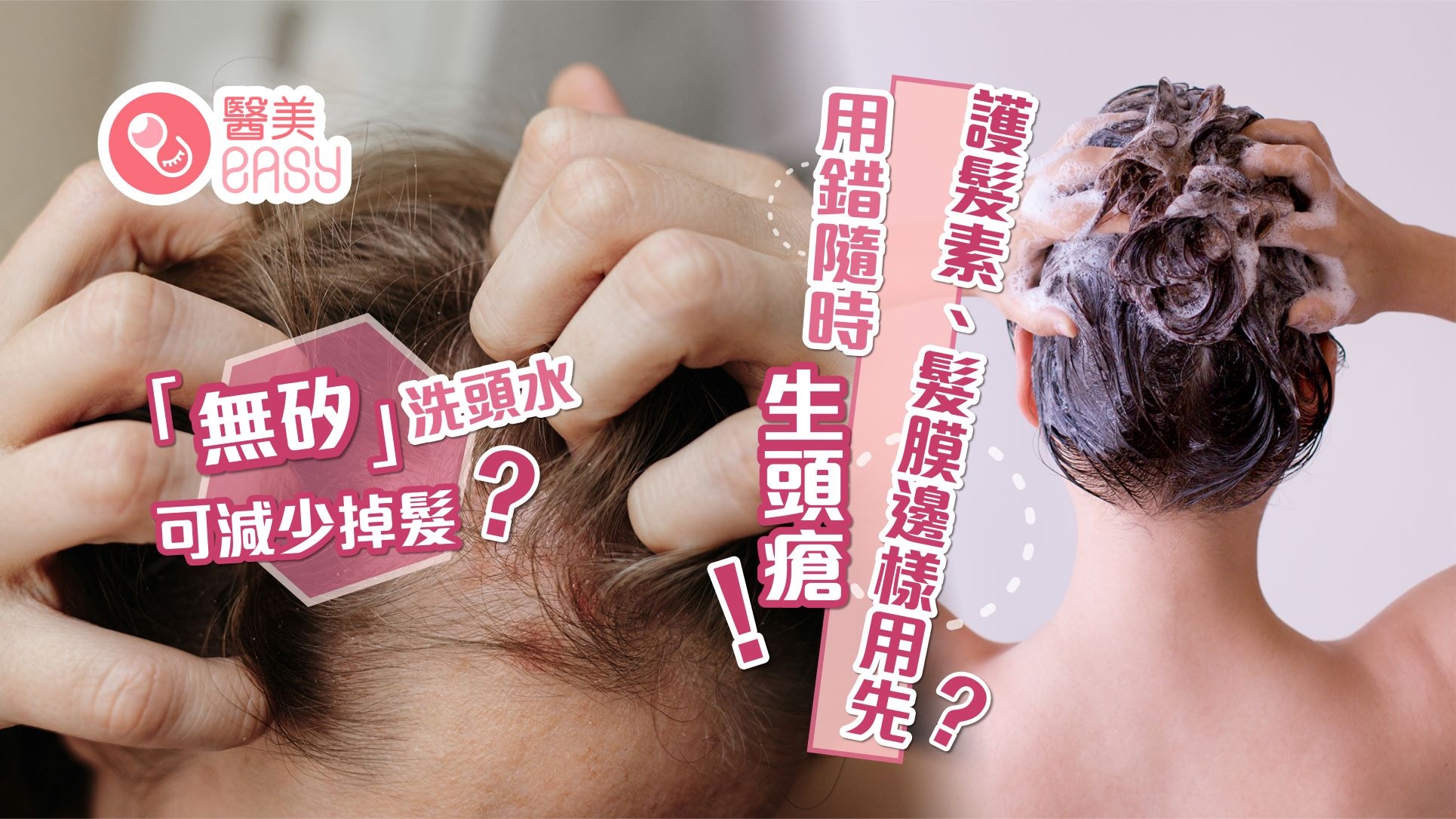 脫髮｜無矽洗頭水可防脫髮？用錯洗髮護髮次序隨時導致頭皮發炎！