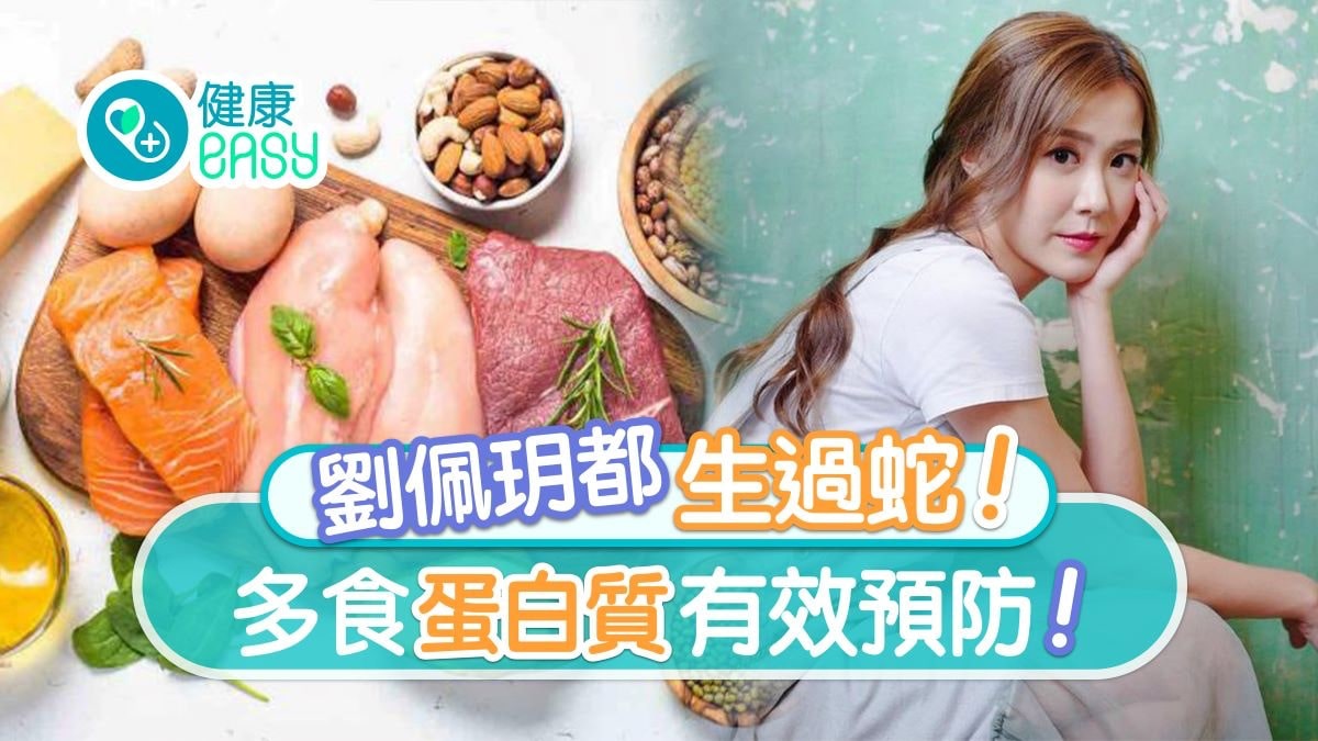 生蛇｜劉佩玥自爆似火燒超級痛！10個須知把握黃金72小時小心留疤