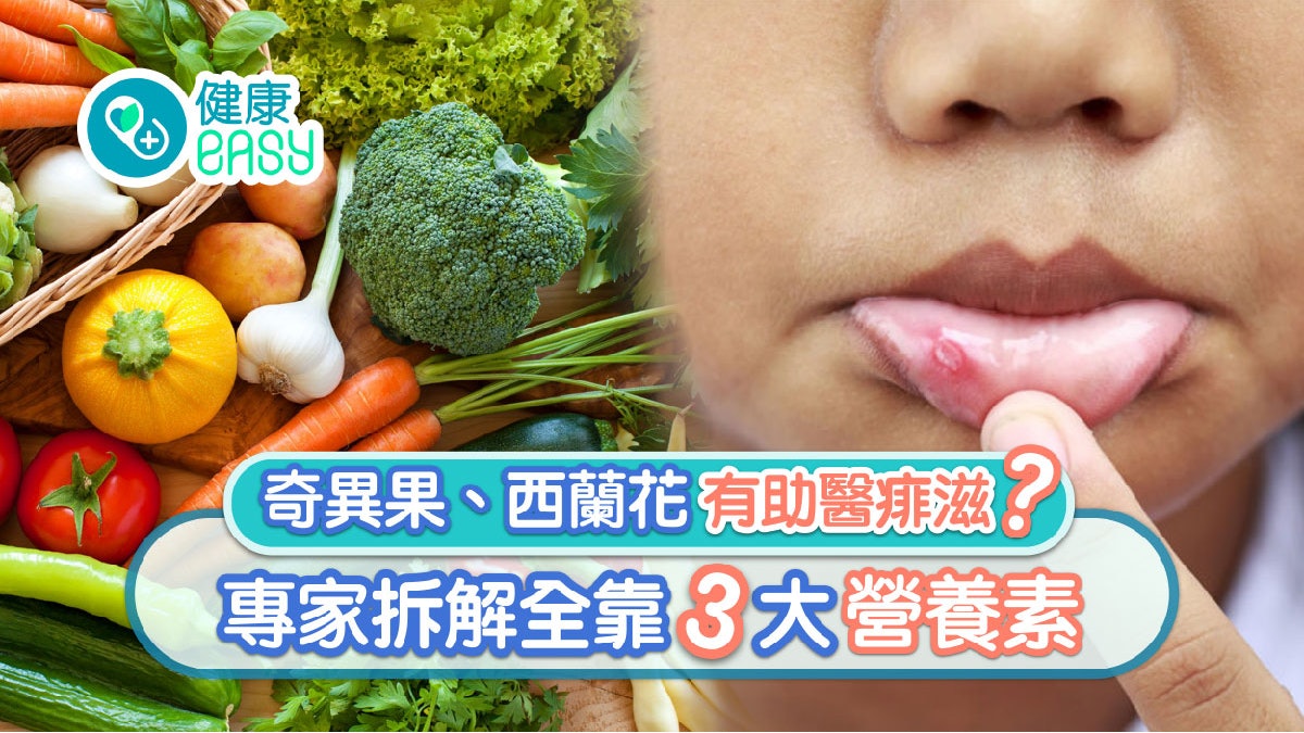 痱滋|舌頭、唇頰成痱滋「災區 」 3大營養素助快速復原+預防! 痱滋|舌頭、唇頰成痱滋「災區 」 3大營養素助快速復原+預防!