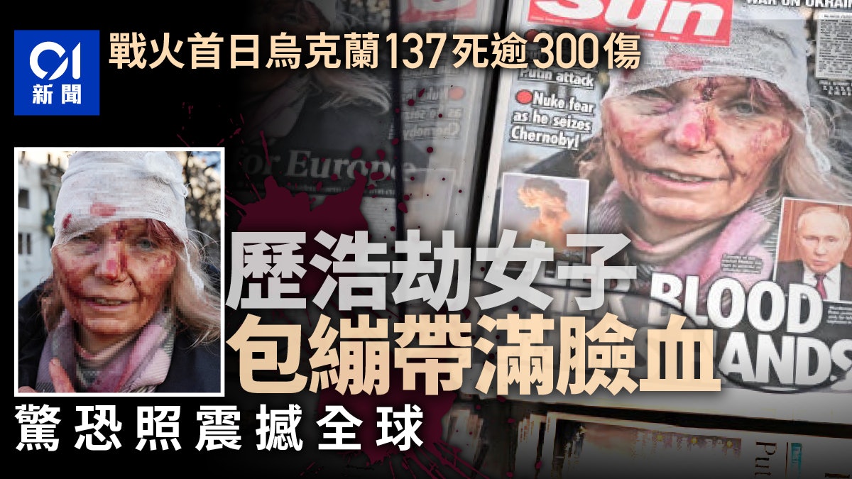 烏克蘭局勢|經歷轟炸逃過死神 烏克蘭婦女染血驚恐照震撼全球 烏克蘭局勢|經歷轟炸逃過死神 烏克蘭婦女染血驚恐照震撼全球