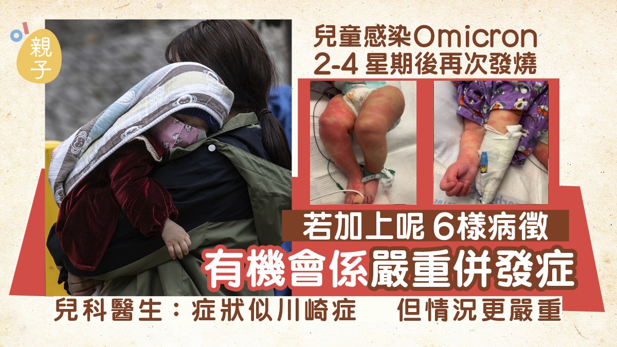 兒童感染Omicron2至4周再發燒及現6項病徵 醫生:或是嚴重併發症 兒童感染Omicron2至4周再發燒及現6項病徵 醫生:或是嚴重併發症