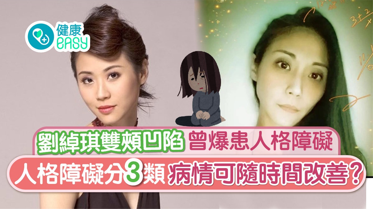 劉綽琪雙頰凹陷曾爆患人格障礙 人格障礙分3類病情可隨時間改善? 劉綽琪雙頰凹陷曾爆患人格障礙 人格障礙分3類病情可隨時間改善?