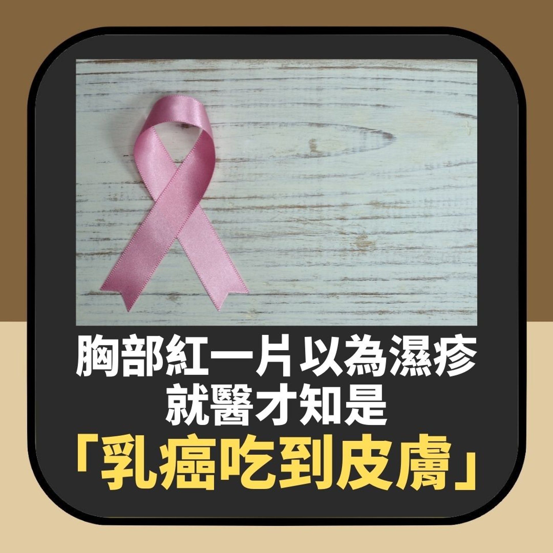 胸部紅一片以為濕疹 直到乳頭凹陷先就醫 驚揭「乳癌吃到皮膚」(01製圖) 胸部紅一片以為濕疹 直到乳頭凹陷先就醫 驚揭「乳癌吃到皮膚」(01製圖)