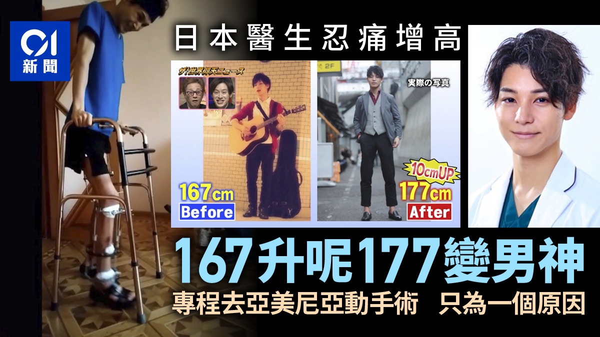 日本矮男花500萬日圓變177cm男神骨骼延長手術看着都覺得痛