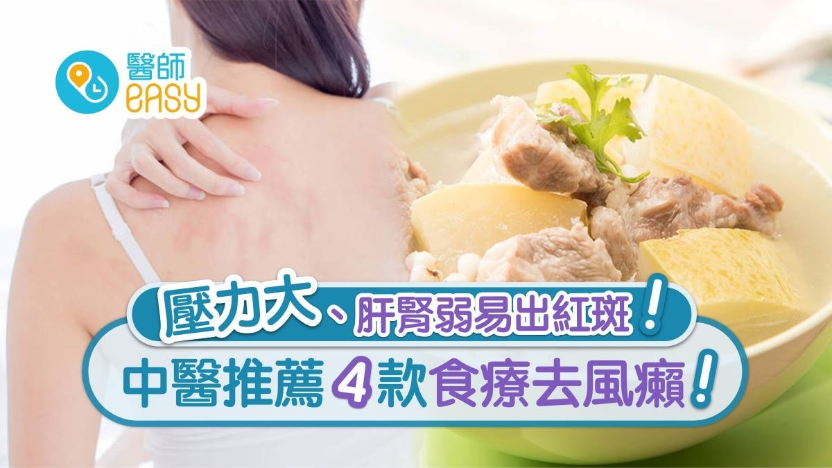 【風癩】肝腎弱壓力大易出紅斑 火速止痕有妙法附4款食療治風癩 【風癩】肝腎弱壓力大易出紅斑 火速止痕有妙法附4款食療治風癩