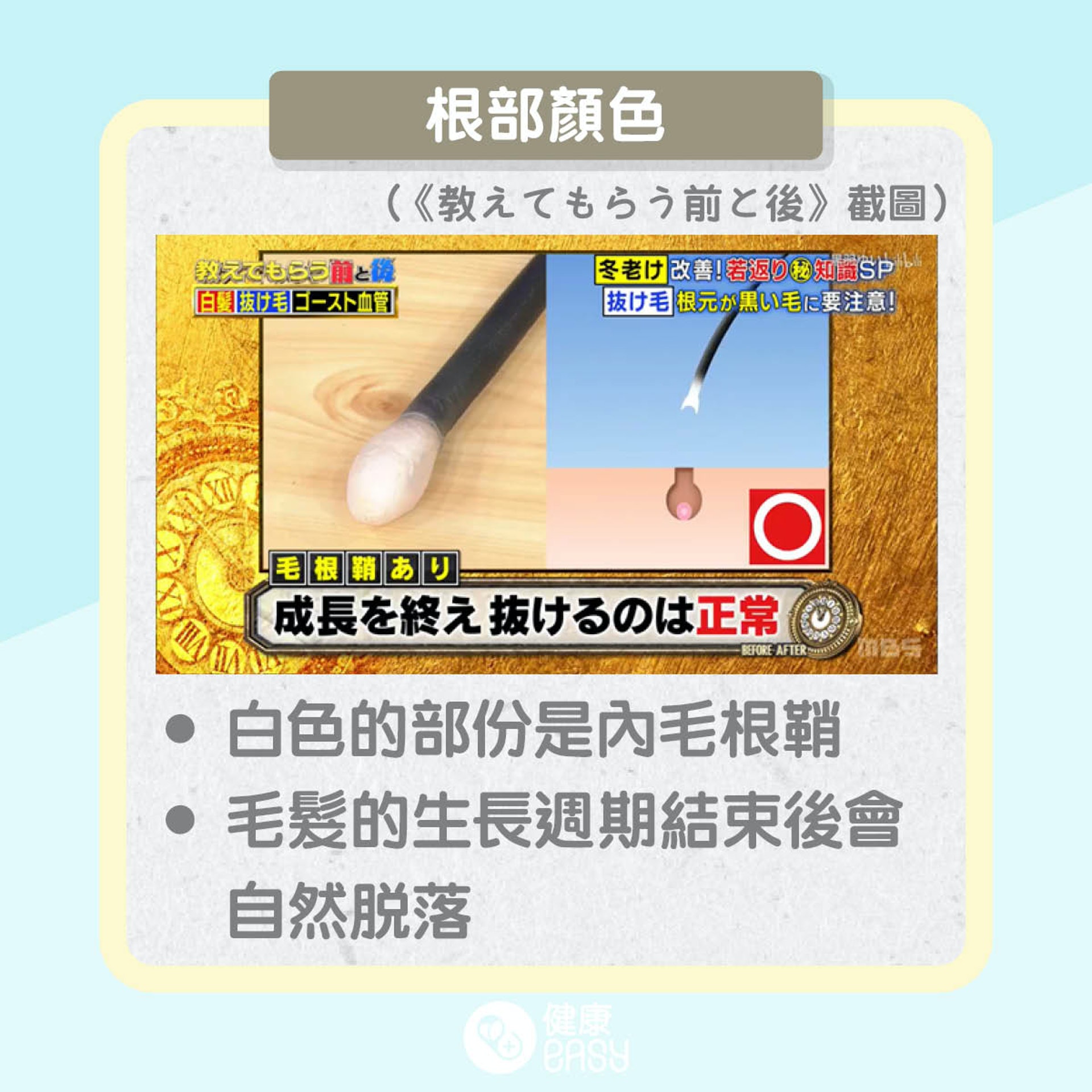 脫髮有分好與壞?(01製圖) 脫髮有分好與壞?(01製圖)