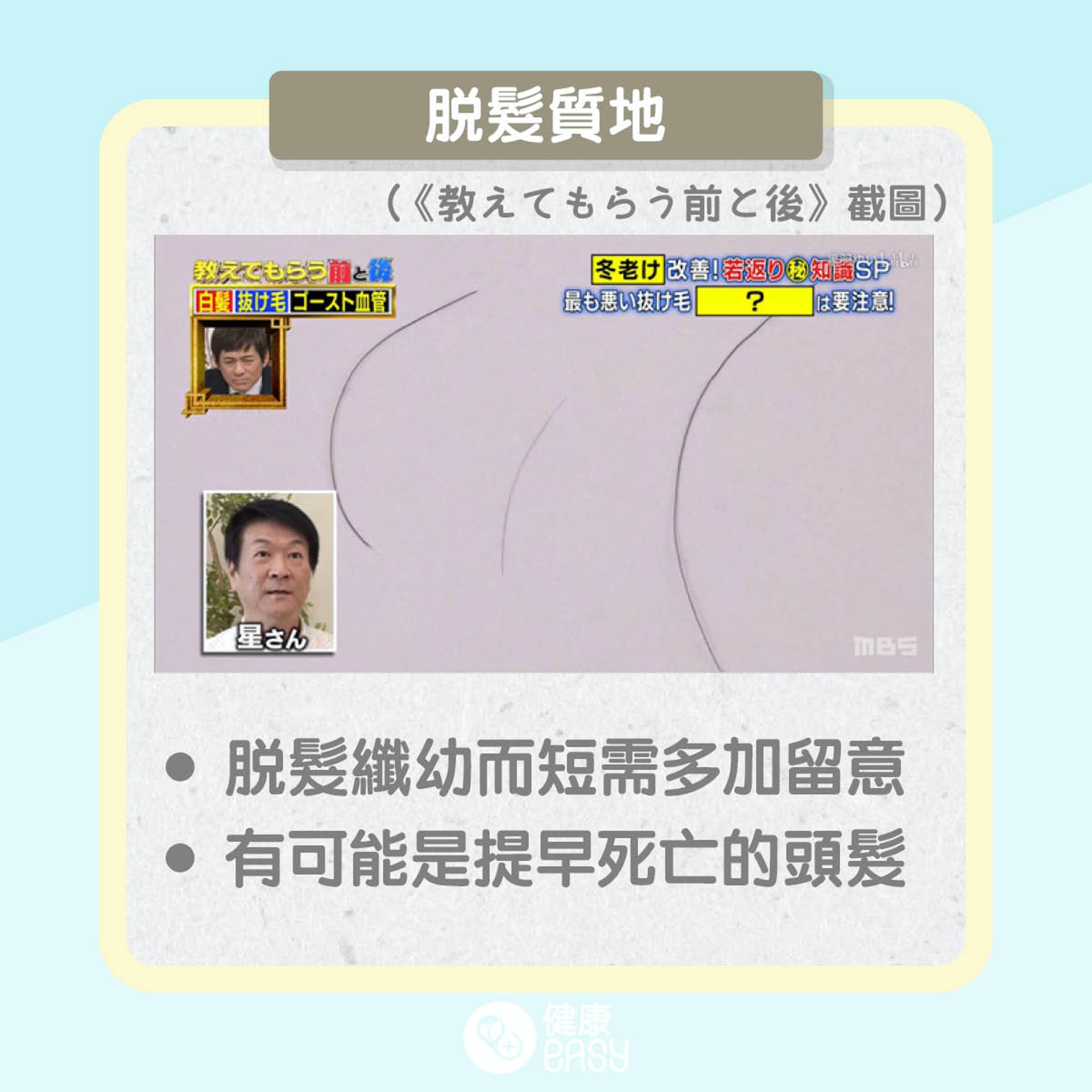 脫髮有分好與壞?(01製圖) 脫髮有分好與壞?(01製圖)