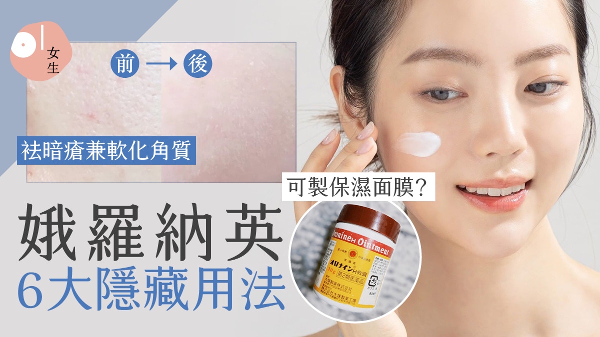 護膚｜娥羅納英6大隱藏用法：加水成面膜很保濕　厚敷袪黑頭暗瘡?