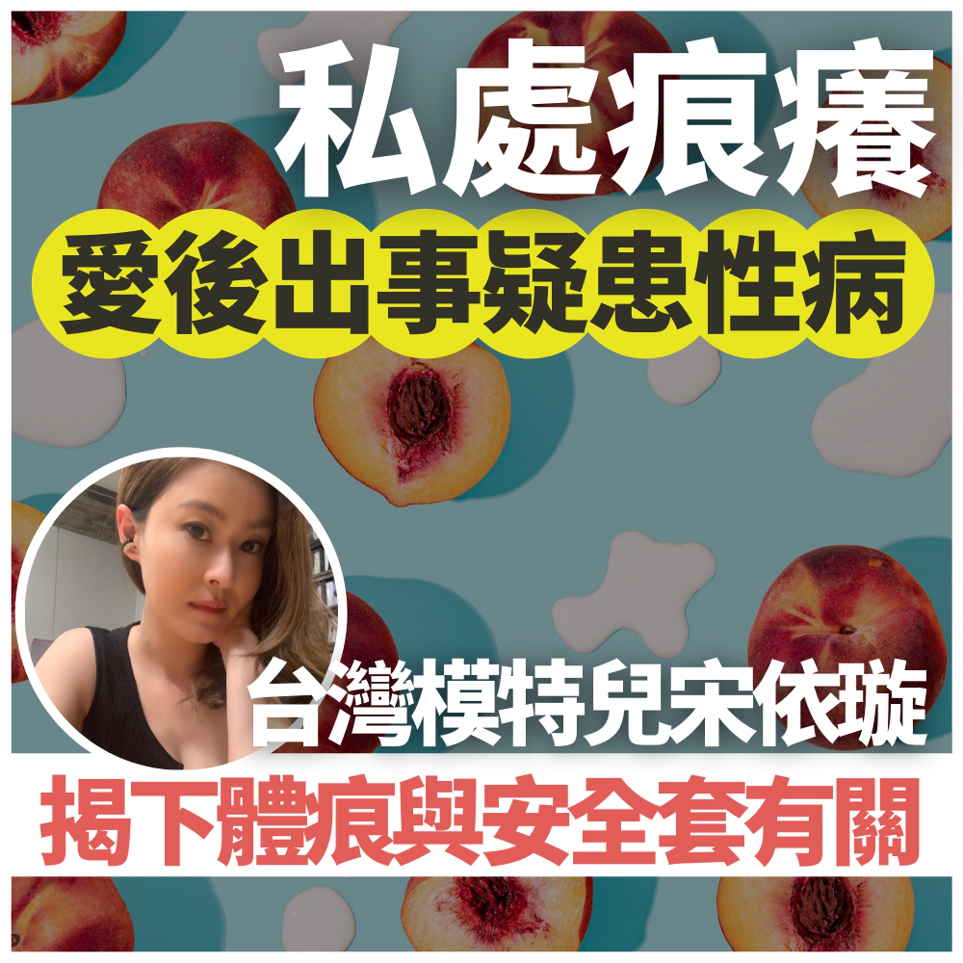 台灣女星「愛後」私處灼熱痕癢疑患性病 醫生驚揭與安全套有關(01製圖/《醫師好辣》截圖/unsplash@Amy Shamblen) 台灣女星「愛後」私處灼熱痕癢疑患性病 醫生驚揭與安全套有關(01製圖/《醫師好辣》截圖/unsplash@Amy Shamblen)