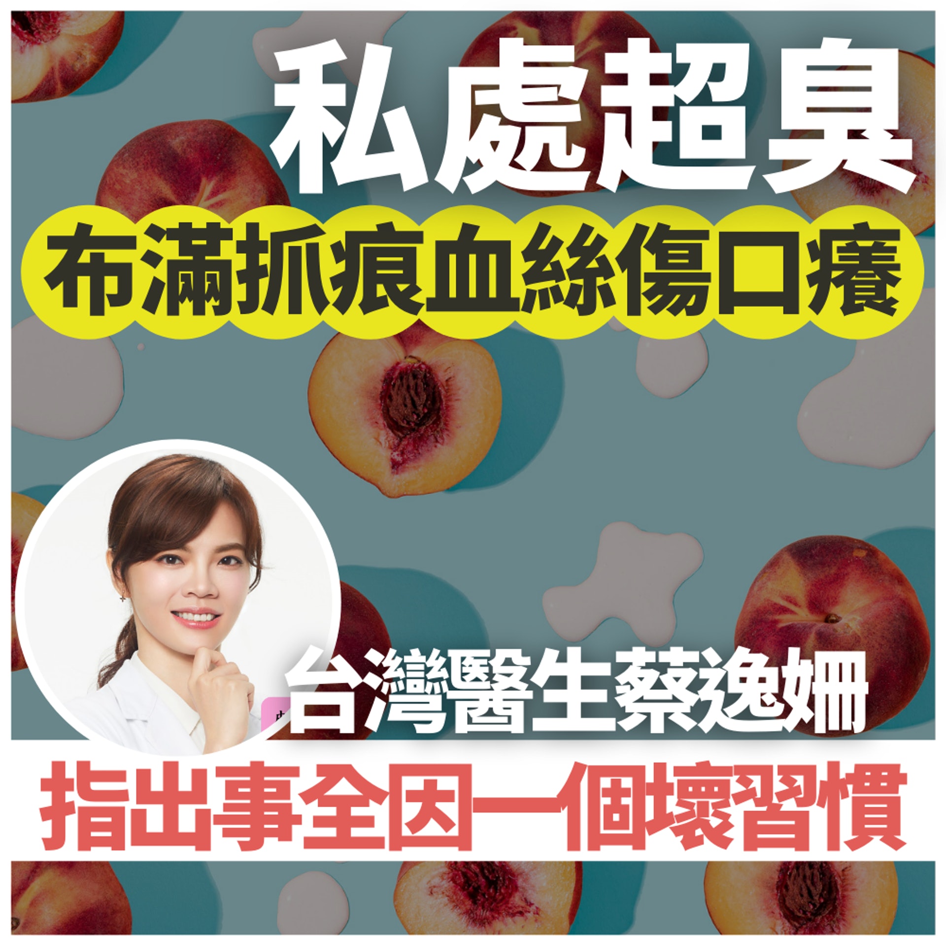 台女被嫌私處臭急求醫 揭下身布滿抓痕血絲 出事全因一個壞習慣(01製圖/FB@皮膚科蔡逸姍醫師/unsplash@Amy Shamblen) 台女被嫌私處臭急求醫 揭下身布滿抓痕血絲 出事全因一個壞習慣(01製圖/FB@皮膚科蔡逸姍醫師/unsplash@Amy Shamblen)