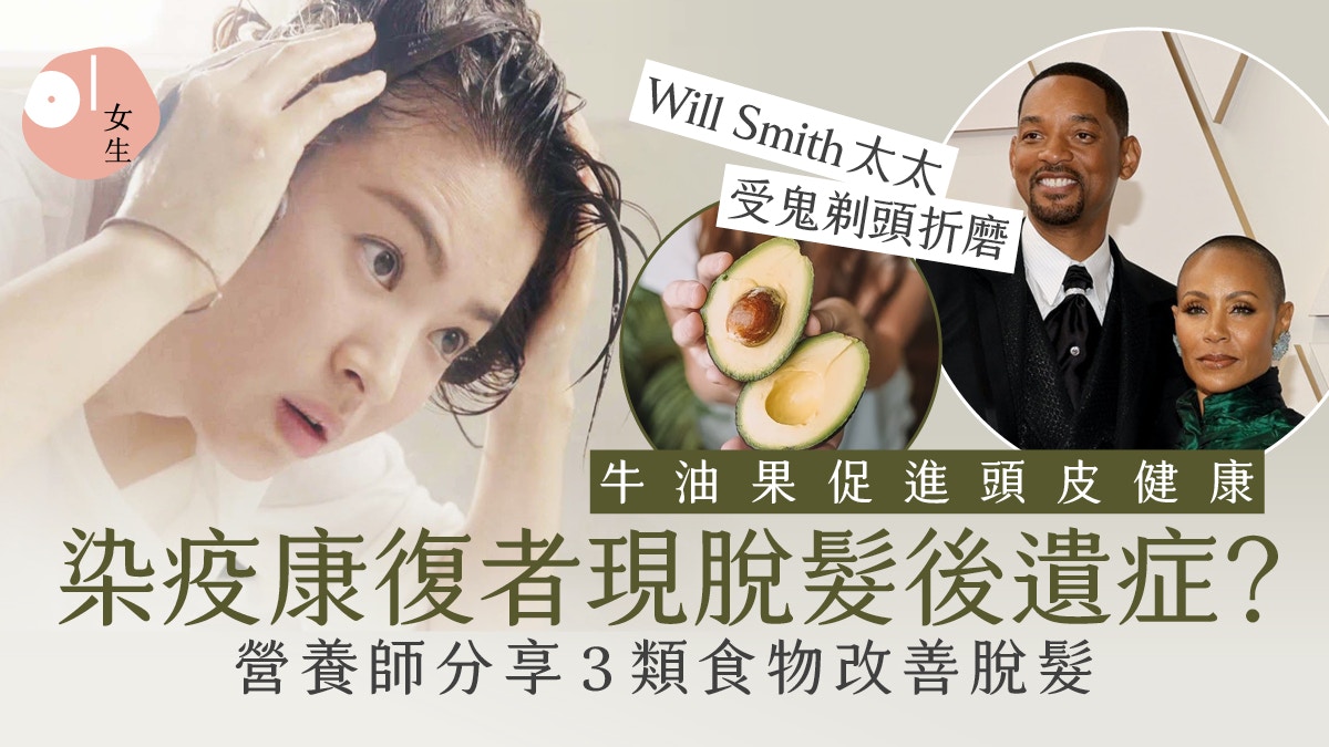 脫髮問題無分男女 營養師教3招預防脫髮 改變進食白飯麵包習慣