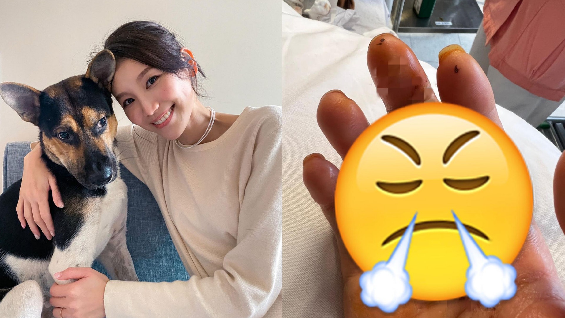 鄧美欣狗咬傷勢持續惡化仍留醫 家人撞正狗主對方速逃:不可原諒 鄧美欣狗咬傷勢持續惡化仍留醫 家人撞正狗主對方速逃:不可原諒